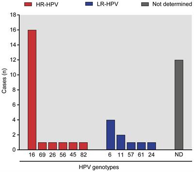 Impact of high-risk and low-risk human papillomavirus infections on the male genital tract: effects on semen inflammation and sperm quality